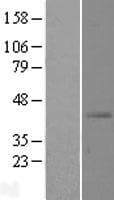 SLC39A13 / ZIP13 Protein (Over-Expression Lysate Myc-DDK (Flag))