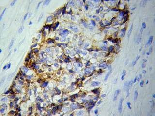 Polyclonal Rabbit anti-Human BVES Antibody (IHC, WB)