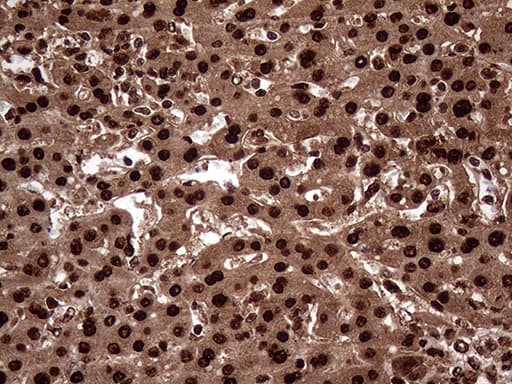 TALDO1 / Transaldolase 1 Antibody (clone OTI2E4)