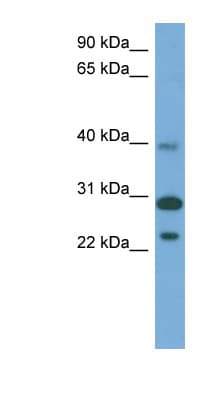 CCDC28A Antibody (aa179-228)