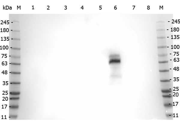 MPO / Myeloperoxidase Antibody