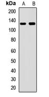Polyclonal Rabbit anti-Human FTSJ3 Antibody (WB)