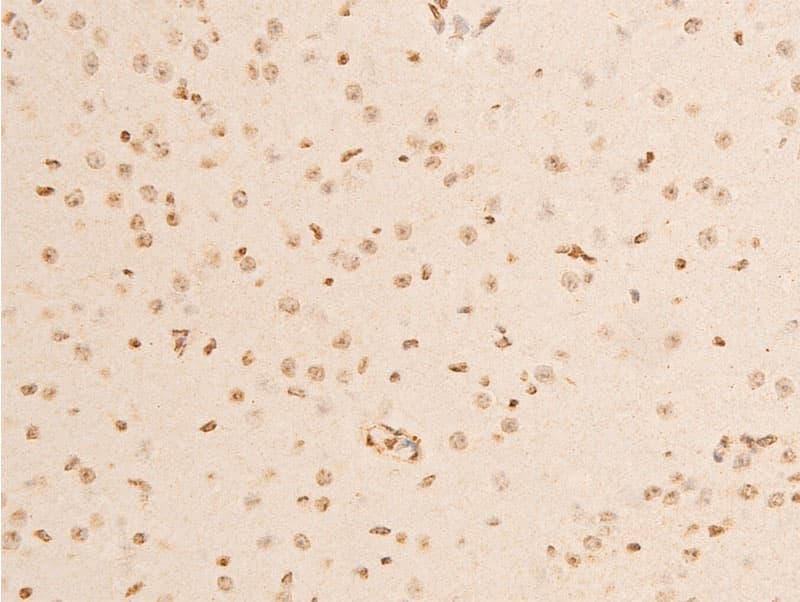 Polyclonal Rabbit anti-Human NFKBIA / IKB Alpha / IKBA Antibody (phospho-Ser32,phospho-Ser36, IHC, IF, WB)
