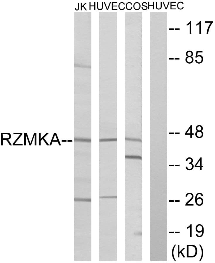 RIMKLA Antibody (aa112-161)