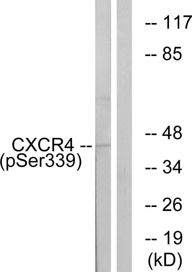 CXCR4 Antibody (phospho-Ser339)
