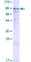 Human DISPA / DISP1 Protein (Recombinant GST)