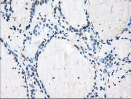 CYPOR / POR Antibody (clone OTI5B3)