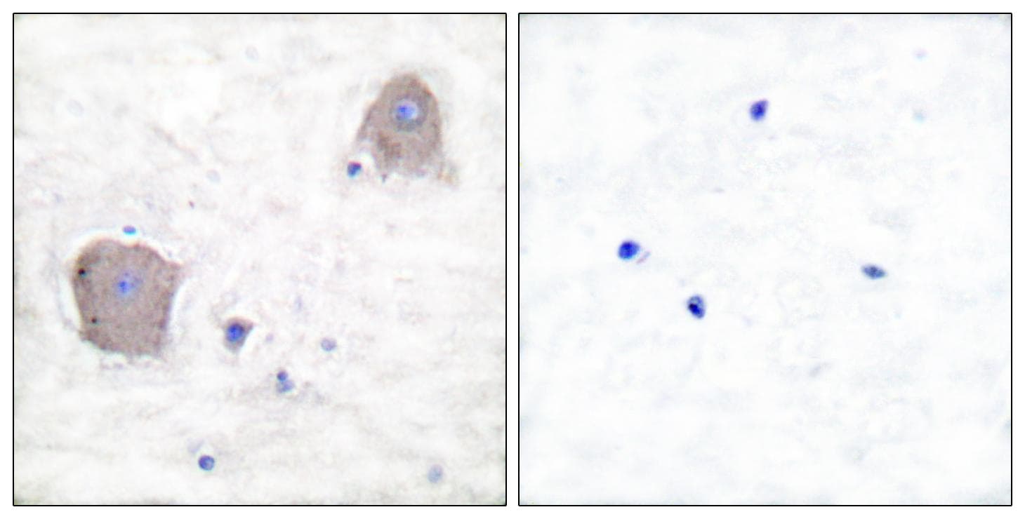 GRIA4 / GLUR4 Antibody