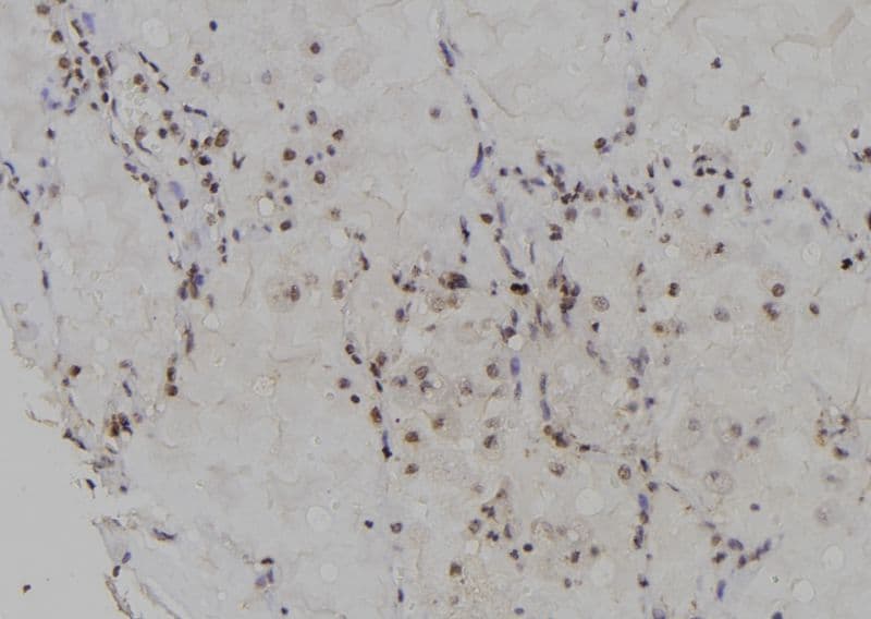 DCK / Deoxycytidine kinase Antibody