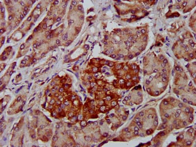 Polyclonal Rabbit anti-Human ADAM8 Antibody (IHC, IF, WB)