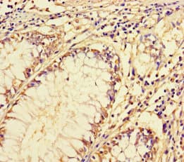 ARL16 Antibody