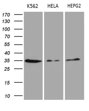 Monoclonal Mouse anti-Human CLTA / LCA Antibody (clone OTI2A6, IHC, WB)