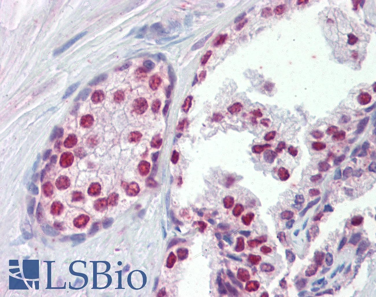 IHC-plus™ FOXA1 Antibody (aa429-439)