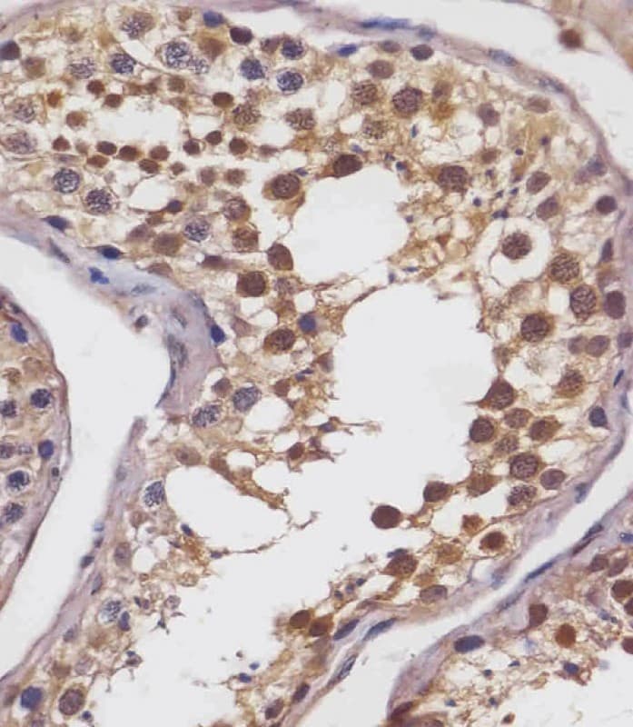 SLC2A8 / GLUT8 Antibody (Internal)