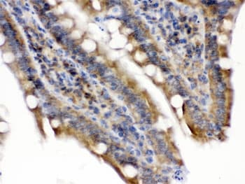 TLN2 / Talin 2 Antibody