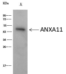 Polyclonal Rabbit anti-Human KRT18 / CK18 / Cytokeratin 18 Antibody (Preservative Free, IHC, WB)