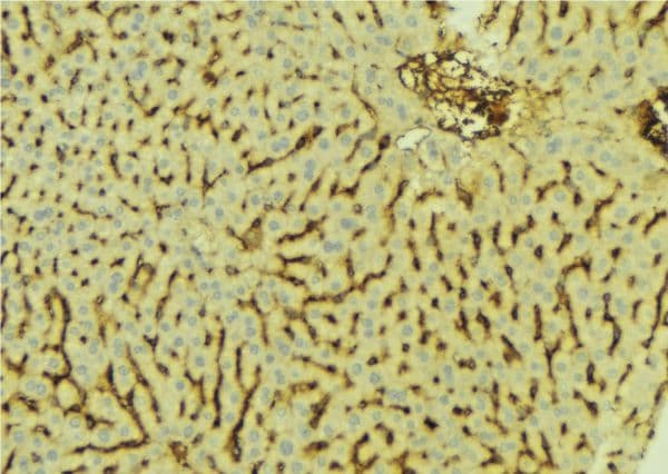 AKR7A2 / AFAR Antibody