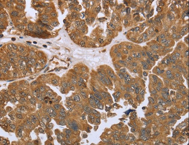 IKBKE / IKKI / IKKE Antibody