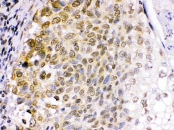 EME1 Antibody