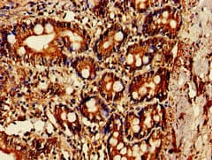 Polyclonal Rabbit anti-Human OAS1 Antibody (IHC)