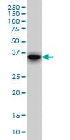 SLIM / FHL1 Antibody (clone 2A9)