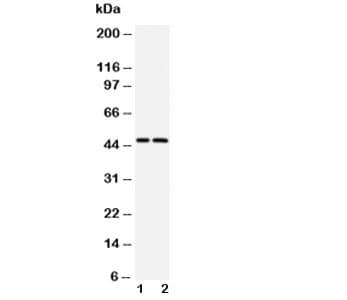 CASP2 / Caspase 2 Antibody (aa417-439)