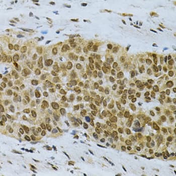 ELAVL1 / HUR Antibody