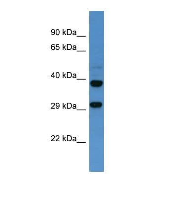 Polyclonal Rabbit anti-Human SSTR2 Antibody (C-Terminus, WB)