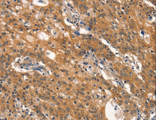 Polyclonal Rabbit anti-Human DNM2 / Dynamin-2 Antibody (IHC, WB)