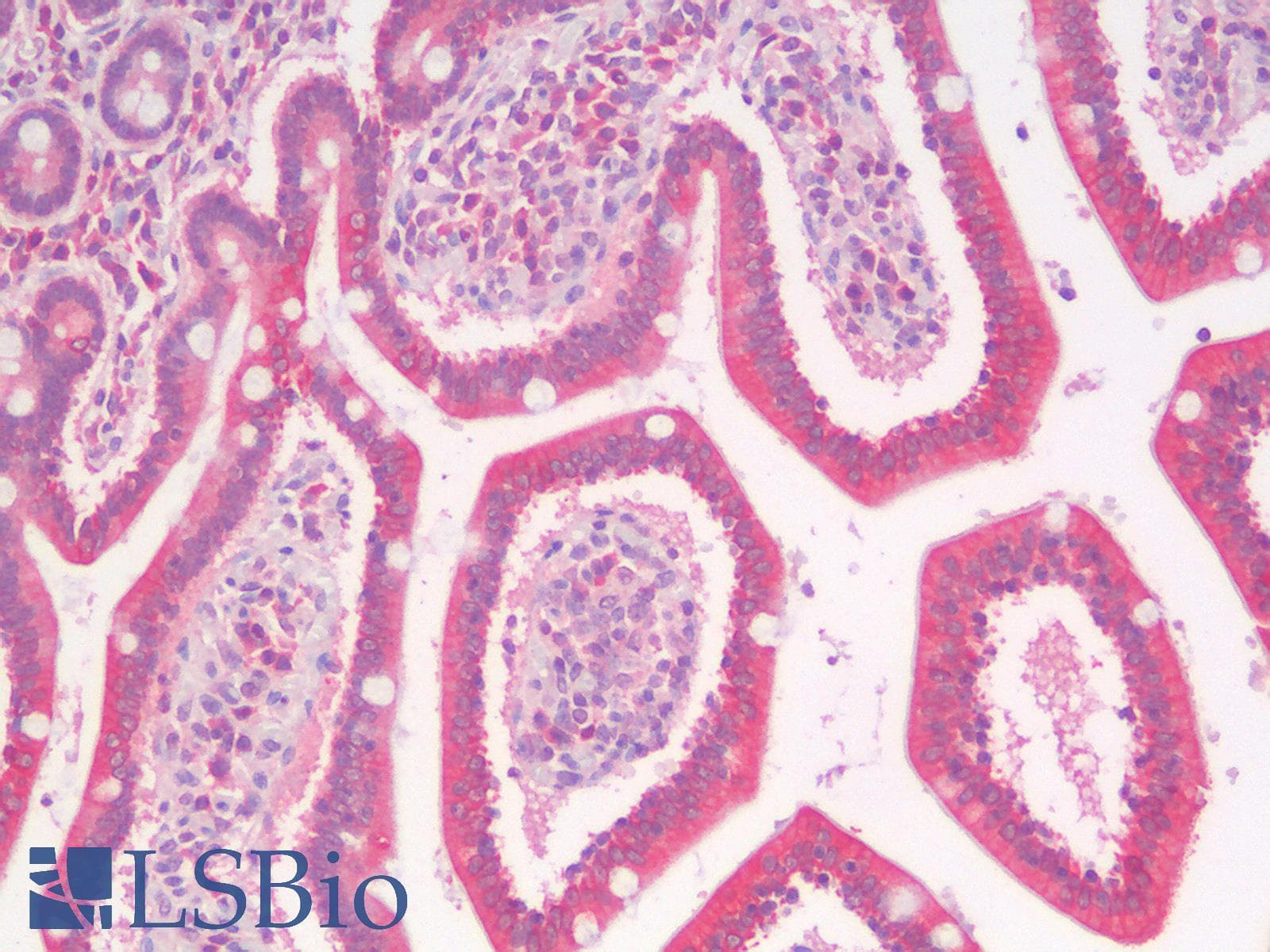 IHC-plus™ KRT8 / CK8 / Cytokeratin 8 Antibody