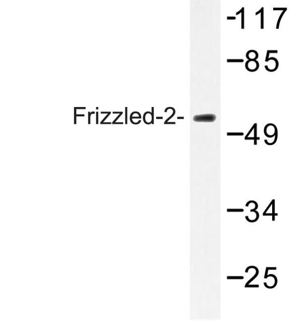 FZD2 / Frizzled 2 Antibody (Glu240)