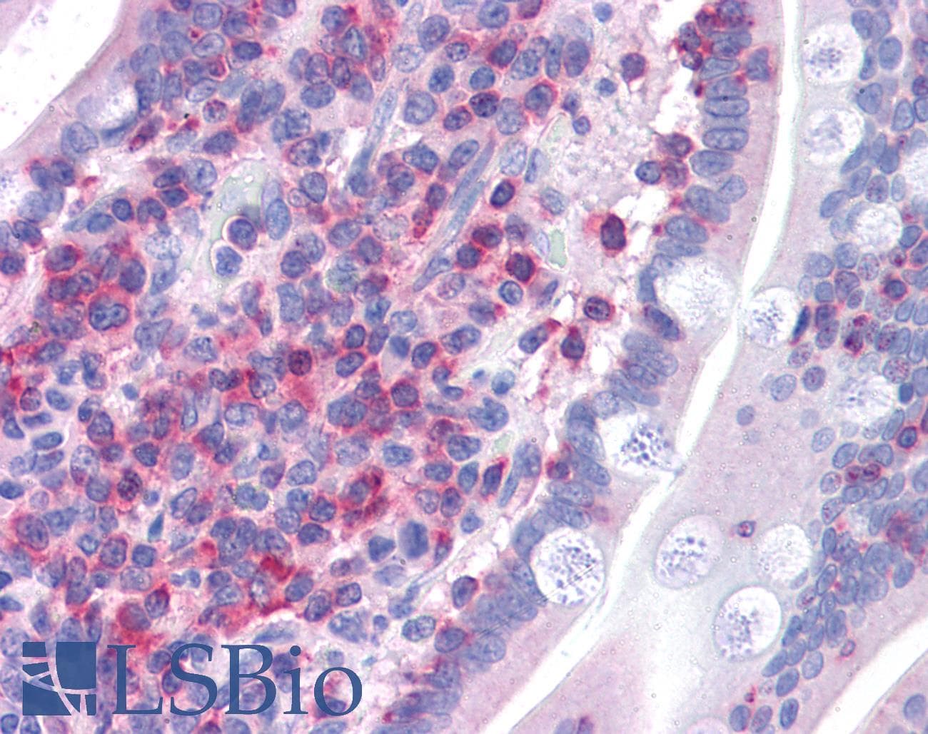 IHC-plus™ FNBP1 / FBP17 Antibody (aa132-145)
