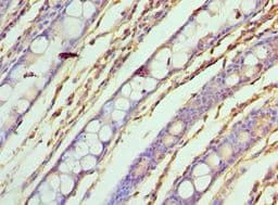Polyclonal Rabbit anti-Human ASF1A Antibody (aa1-204, IHC, WB)