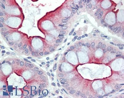 IHC-plus™ Polyclonal Rabbit anti-Human PLA2G2D Antibody (IHC, IF, WB)