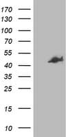 CCM2 / Malcavernin Antibody (clone OTI4F5)