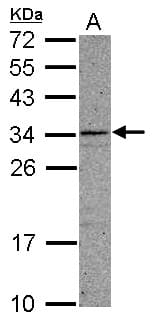 CCDC107 Antibody