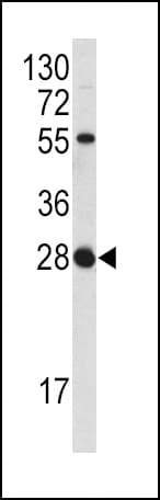 IHC-plus™ FGF18 Antibody (aa23-50)