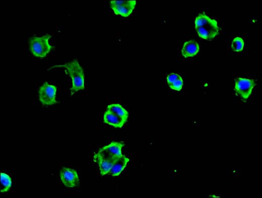 IHC-plus™ Polyclonal Rabbit anti-Human DYNC1H1 Antibody (IHC, IF)