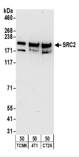 IHC-plus™ NCOA2 / TIF2 Antibody (aa1400-C-term)