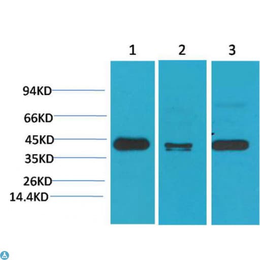 TBP / GTF2D Antibody