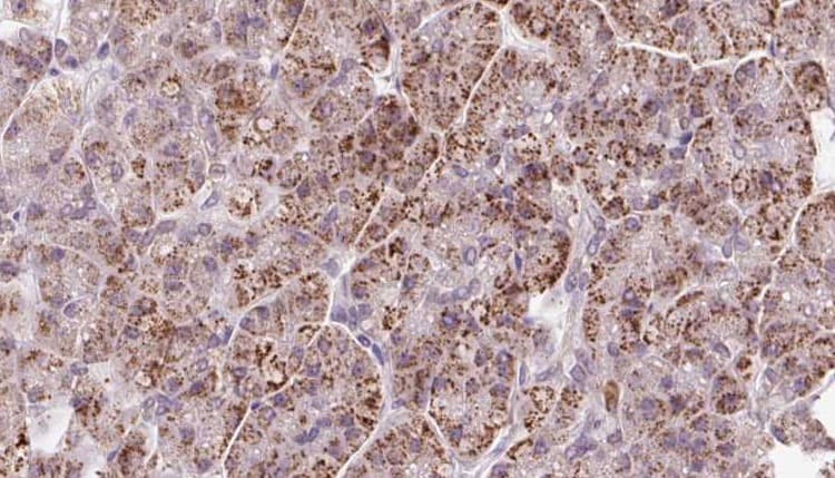 GMF Beta / GMFB Antibody