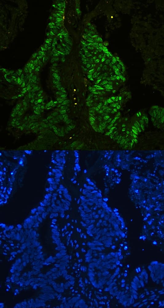 CTBP2 Antibody (aa321-445)