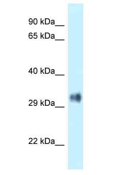 Polyclonal Rabbit anti-Human PITPNB Antibody (aa40-89, WB)