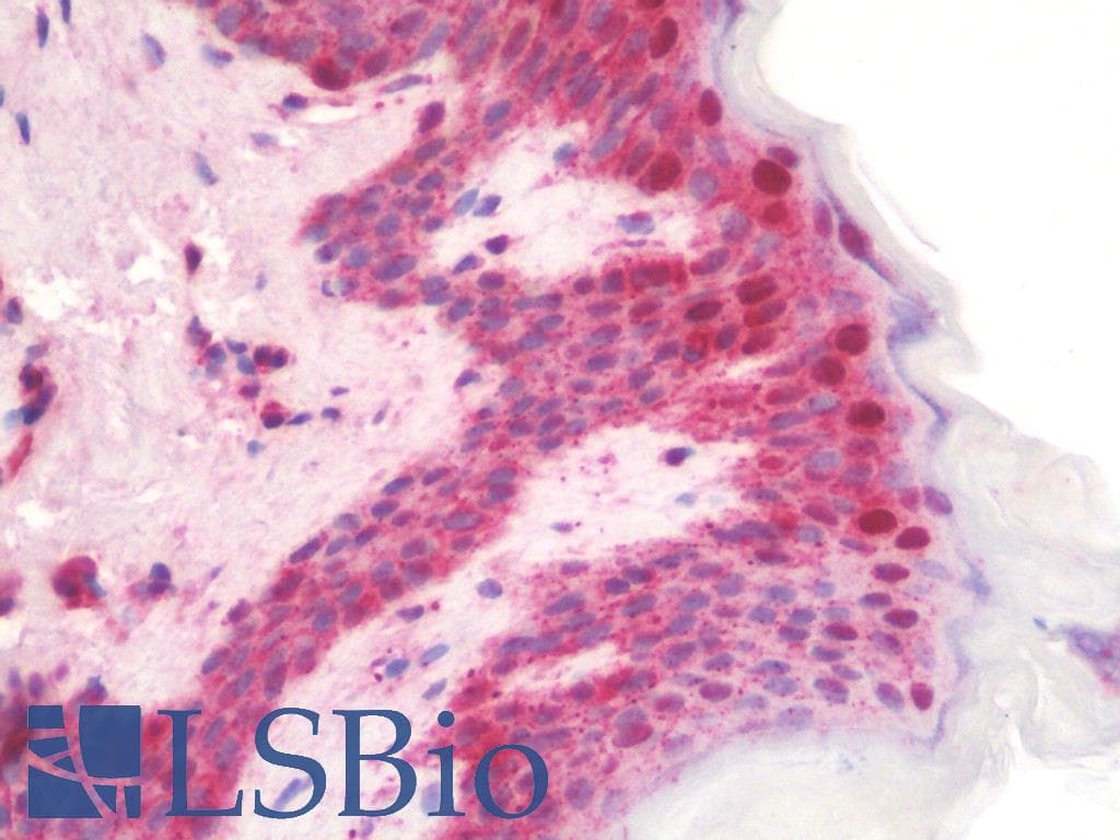 IHC-plus™ KREMEN1 / KREMEN-1 Antibody