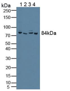 PFKP Antibody (aa553-753)