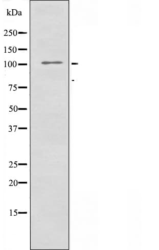 ATXN2L Antibody