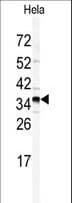Polyclonal Rabbit anti-Human GOLPH3 Antibody (aa1-30, IHC, WB)