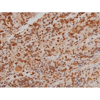 Polyclonal Rabbit anti-Human FLNA / Filamin A Antibody (phospho-Ser2152, IHC, IF, WB)