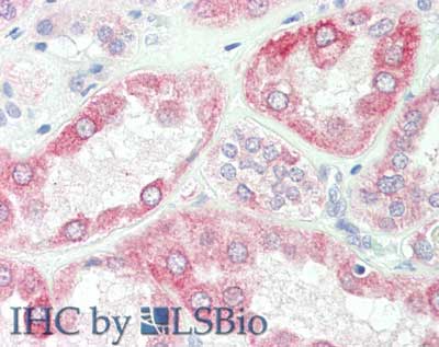 SPRY2 / Sprouty 2 Antibody (Internal)