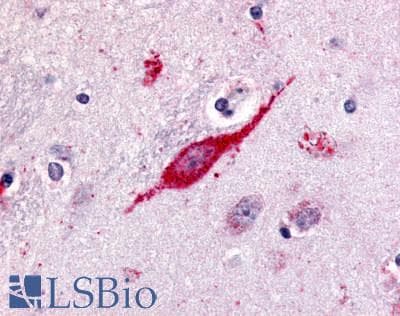 IHC-plus™ SREB / GPR85 Antibody (C-Terminus)
